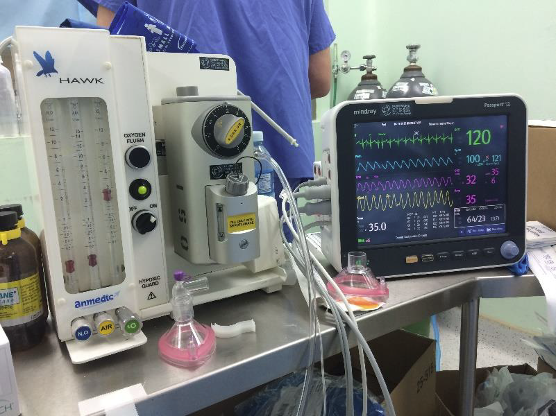 Anethesia Machine and Monitor