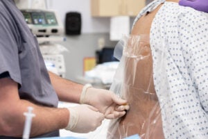 University of Virginia Anesthesiology performs an epidural.