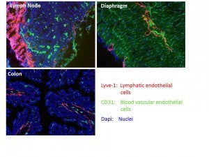 lymph Node, Diaphragm, and Colon