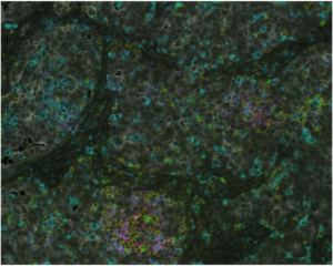 Cancer Immunology Picture 3