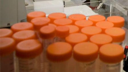 close up of orange caped test tubes