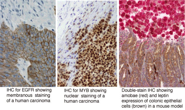 immunohistochemistry immunohistochemistry