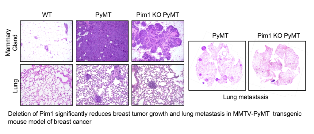 Deletion of PIM1 reduces breast tumor growth and lung metastasis in MMTV PyMT model