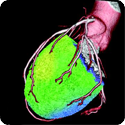 UVA Cardiology