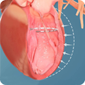 UVA Cardiology
