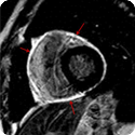UVA Cardiology