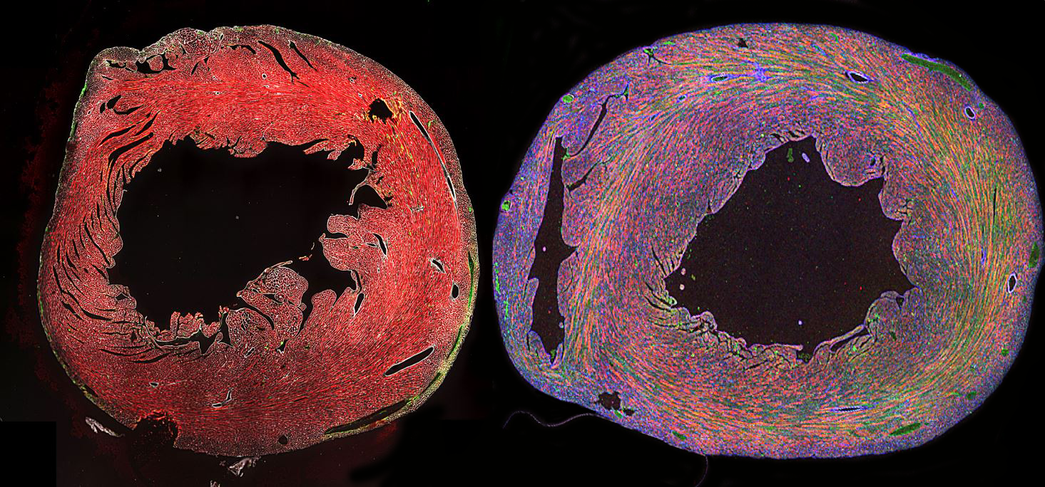 UVA Cardiovascular Medicine Research