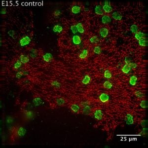 cellular mechanisms of brain development