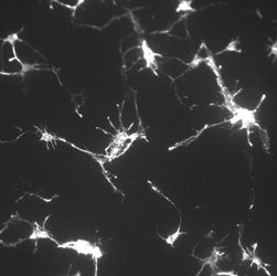 photo of Phalloidin-cortical neurons from mouse brain