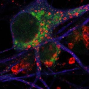 Wincker Neuron labphoto