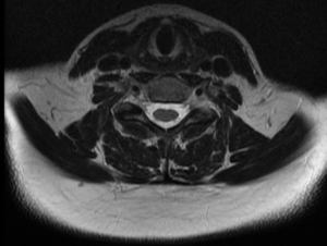  Normal Images of Spine Joshua Li MD PhD