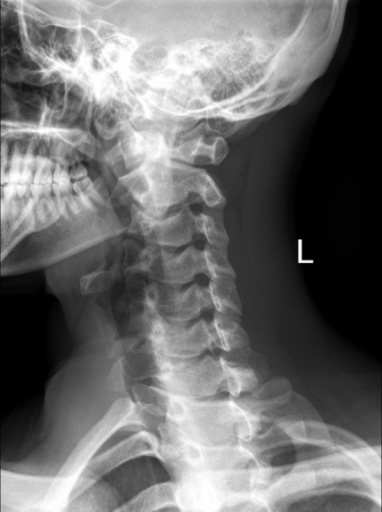 Cervical spine normal anatomy - sagittal view - Male – Medical Art