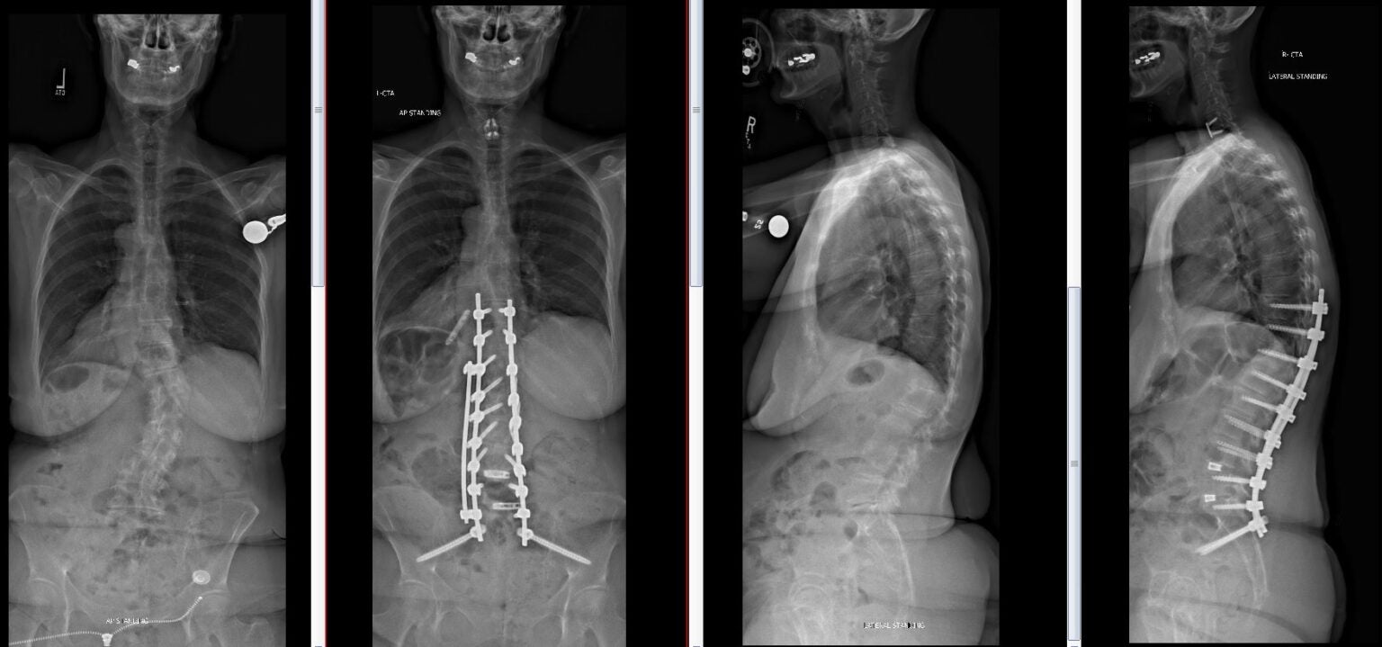 Deformity Surgery Joshua Li MD PhD deformity-surgery-joshua-li-md-phd