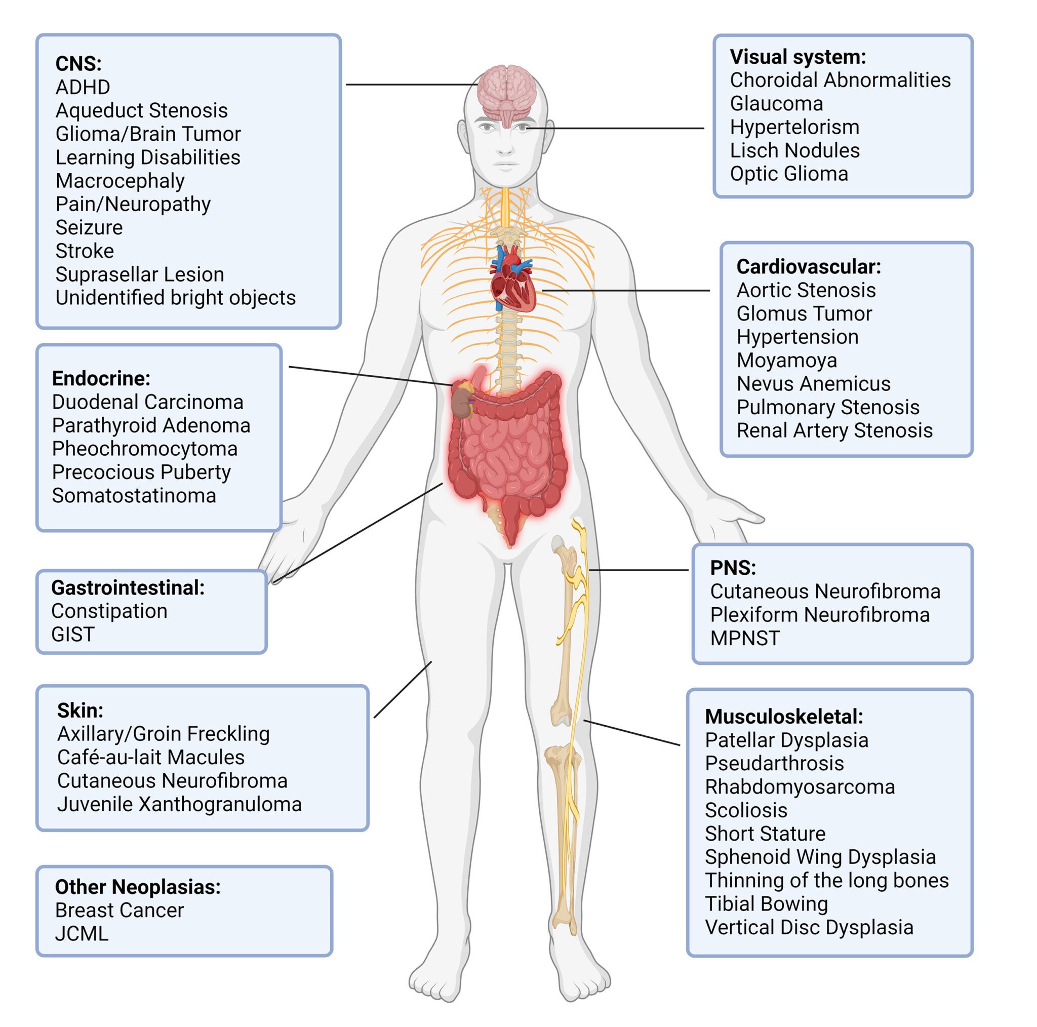 Neurofibromatosis type 1 nf1 le lab