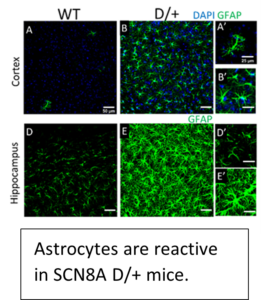 A figure showing astrocyte reactivity in SCN8A D/+ mice.