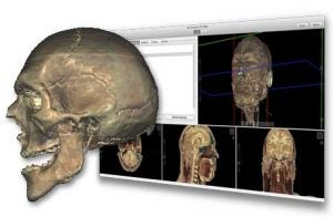 scientific diagram skull cross section