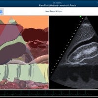 Uva Medical simulation tools