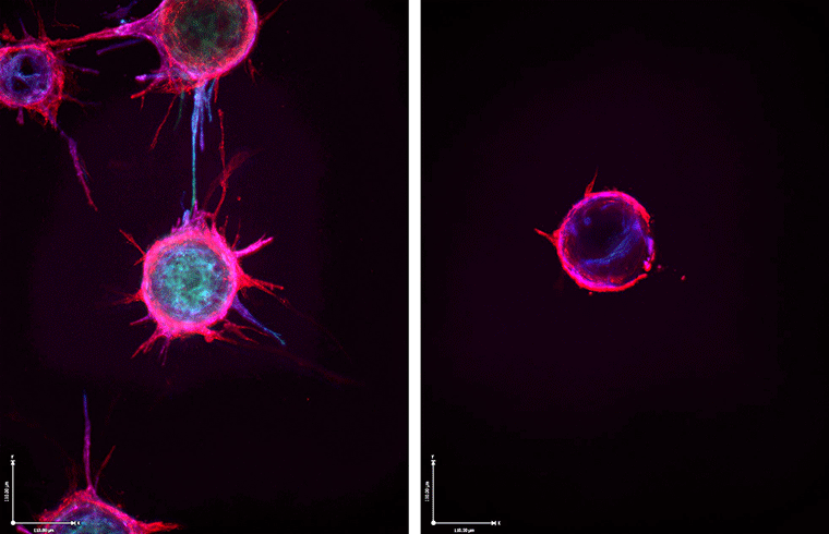 The image on the left depicts blood vessel budding, while the right shows the lack of budding after treatment with microRNA. This suggests a potential avenue to prevent cancer from creating its own blood supply. (Image courtesy Dudley lab)