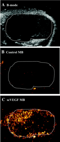 ultrasound imaging of colon adenocarcinoma using microbubbles