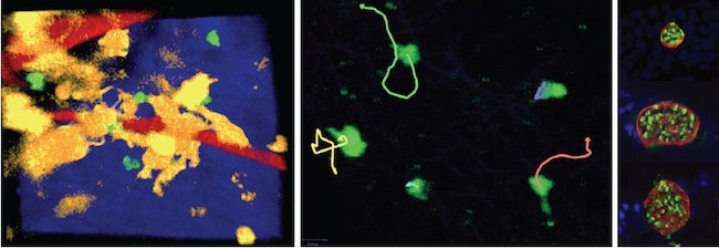 Pictures of cells in the brains of live T. gondii-infected mice