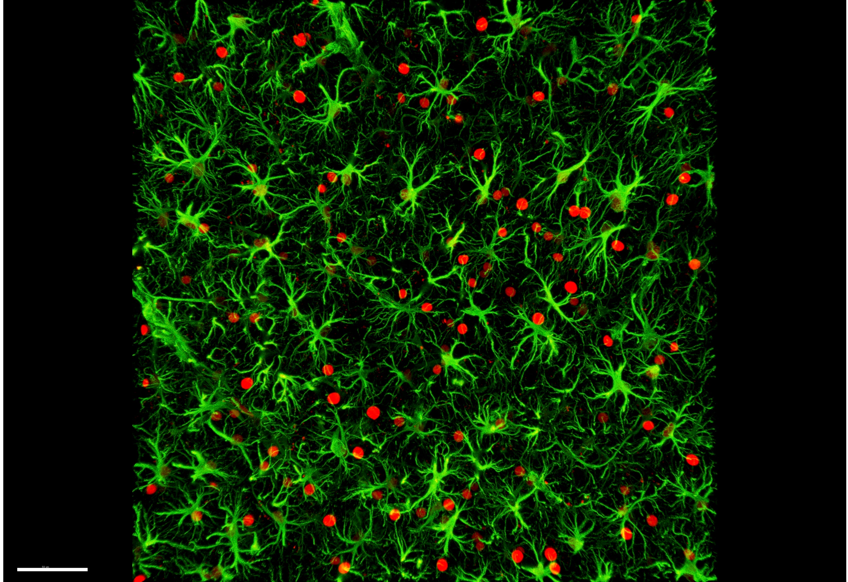 Astrocytes in infected brain