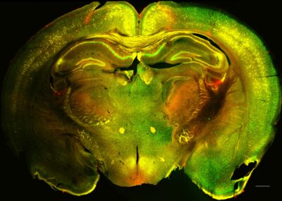 Brain Harald Sontheimer UVA