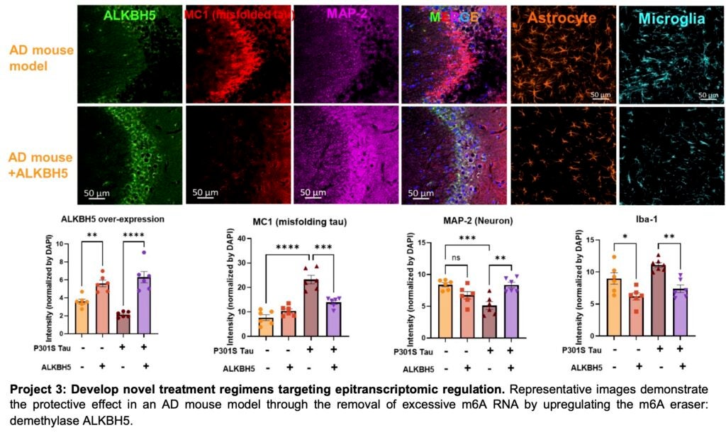 Lulu Jiang epitranscriptomic regulation 