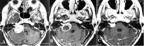 fig19