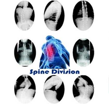 Cervical Spine Fusion  Advanced Orthopaedics & Sports Medicine