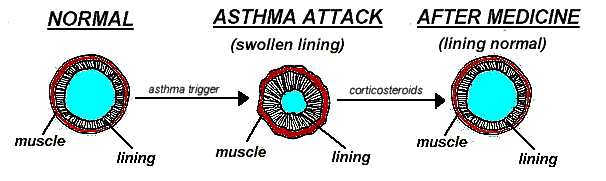 antiinflam