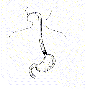 diagram of normal intestinal process