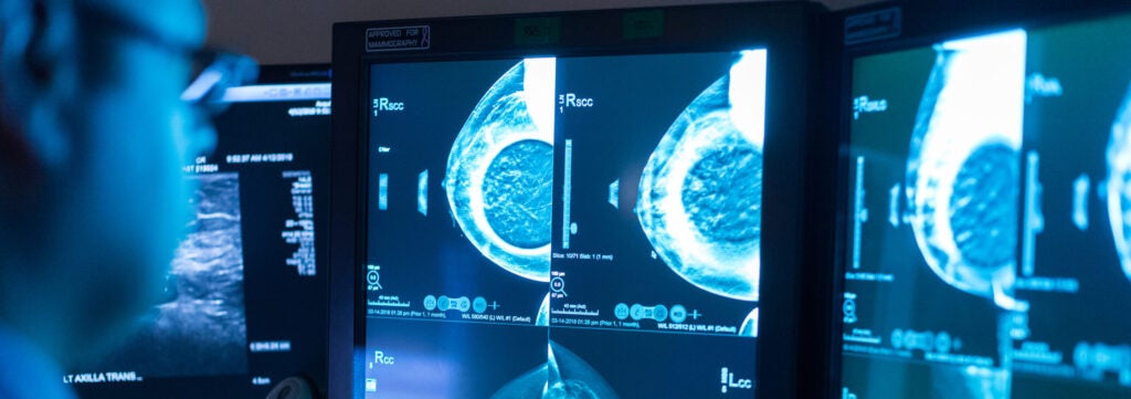 UVA Radiology Breast Imaging workstation