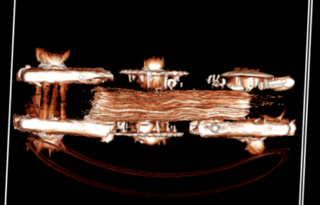 Image from a CT scan of the medieval choir book