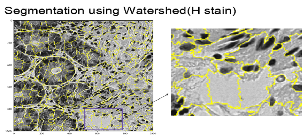 Segmentation using Watershed (H stain)