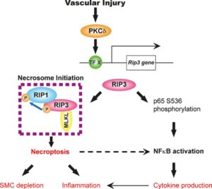 Receptor Interacting-Protein Kinase 3 Contributes to Abdominal Aortic Aneurysms via Smooth Muscle Cell-Necrosis and Inflammation