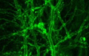 neurons